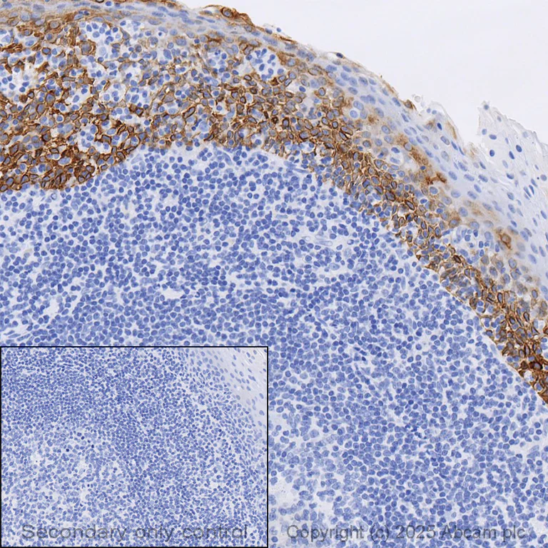 Immunohistochemistry (Formalin/PFA-fixed paraffin-embedded sections) - Anti-Cytokeratin 14 antibody [LL002] - BSA and Azide free (AB212547)