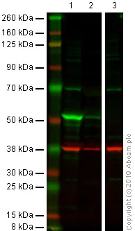 Western blot - Anti-Cytokeratin 14 antibody [LL002] - BSA and Azide free (AB212547)