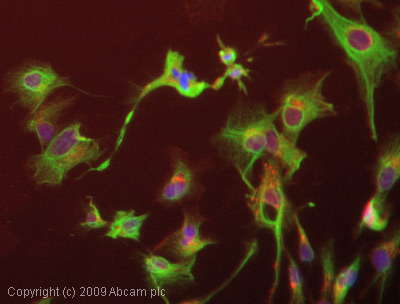 Immunocytochemistry/ Immunofluorescence - Anti-Cytokeratin 14 antibody [RCK107] (AB9220)