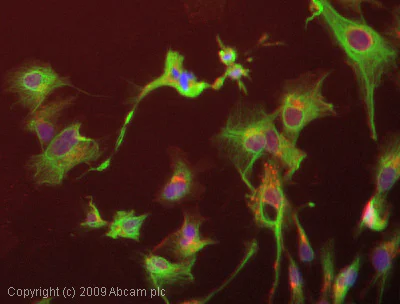 Immunocytochemistry/ Immunofluorescence - Anti-Cytokeratin 14 antibody [RCK107] (AB9220)