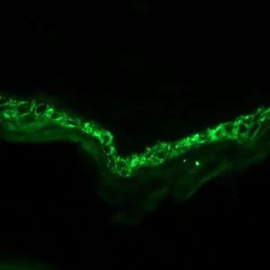 Immunohistochemistry (Frozen sections) - Anti-Cytokeratin 14 antibody [RCK107] (AB9220)