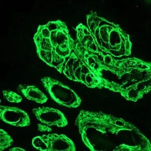 Immunohistochemistry (Frozen sections) - Anti-Cytokeratin 14 antibody [RCK107] (AB9220)