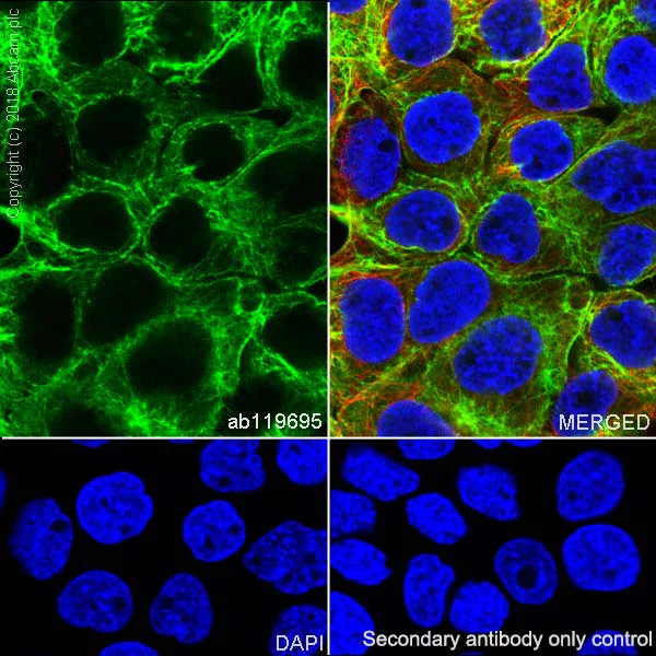 Immunocytochemistry/ Immunofluorescence - Anti-Cytokeratin 14 antibody [SP53] - BSA and Azide free (AB236439)