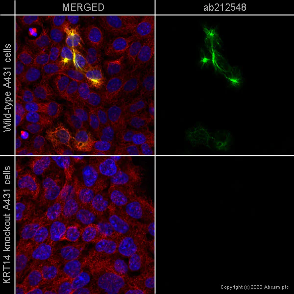 Immunocytochemistry - Anti-Cytokeratin 14 antibody [SPM263] - BSA and Azide free (AB212548)