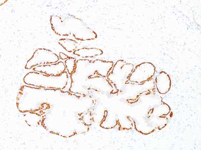 Immunohistochemistry (Formalin/PFA-fixed paraffin-embedded sections) - Anti-Cytokeratin 14 antibody [SPM263] - BSA and Azide free (AB212548)