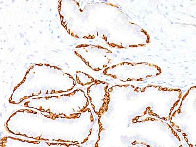 Immunohistochemistry (Formalin/PFA-fixed paraffin-embedded sections) - Anti-Cytokeratin 14 antibody [SPM263] - BSA and Azide free (AB212548)