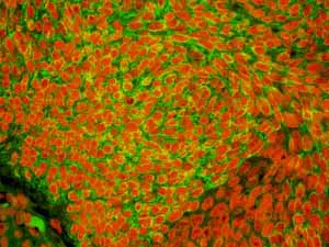 Immunohistochemistry (Formalin/PFA-fixed paraffin-embedded sections) - Anti-Cytokeratin 15 antibody [EPR1614Y] (AB52816)