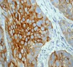 Immunohistochemistry (Formalin/PFA-fixed paraffin-embedded sections) - Anti-Cytokeratin 15 antibody [EPR1614Y] (AB52816)