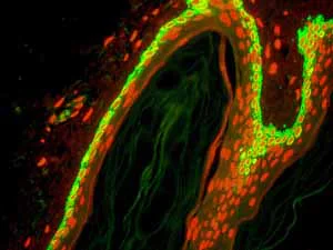 Immunohistochemistry (Formalin/PFA-fixed paraffin-embedded sections) - Anti-Cytokeratin 15 antibody [EPR1614Y] - BSA and Azide free (AB239850)