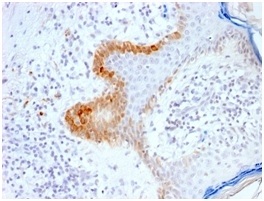 Immunohistochemistry (Formalin/PFA-fixed paraffin-embedded sections) - Anti-Cytokeratin 15 antibody [KRT15/2103R] (AB234322), expandable thumbnail