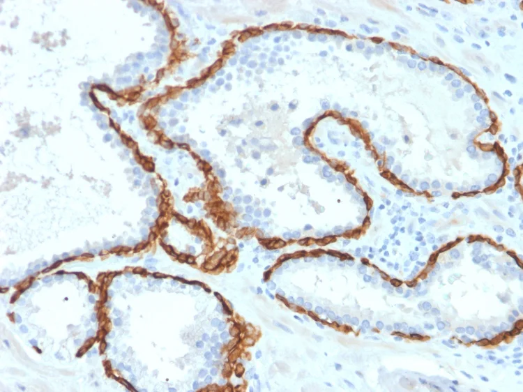 Immunohistochemistry (Formalin/PFA-fixed paraffin-embedded sections) - Anti-Cytokeratin 15 antibody [KRT15/2958] - BSA and Azide free (AB268199)