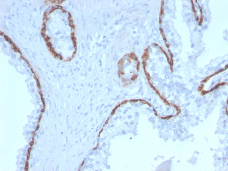 Immunohistochemistry (Formalin/PFA-fixed paraffin-embedded sections) - Anti-Cytokeratin 15 antibody [KRT15/2958] - BSA and Azide free (AB268199), expandable thumbnail