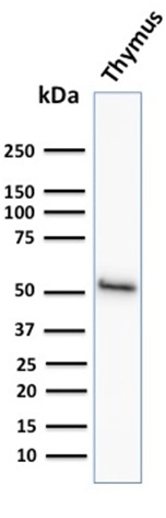 Western blot - Anti-Cytokeratin 15 antibody [KRT15/2958] - BSA and Azide free (AB268199), expandable thumbnail