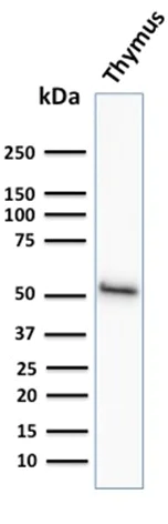 Western blot - Anti-Cytokeratin 15 antibody [KRT15/2958] - BSA and Azide free (AB268199)
