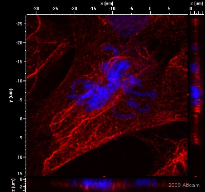 Immunocytochemistry/ Immunofluorescence - Anti-Cytokeratin 15 antibody [LHK15] (AB80522), expandable thumbnail