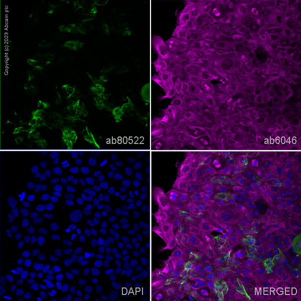 Immunocytochemistry/ Immunofluorescence - Anti-Cytokeratin 15 antibody [LHK15] (AB80522), expandable thumbnail