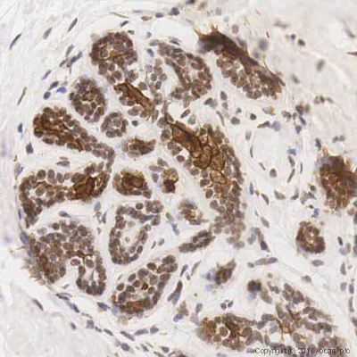 Immunohistochemistry (Formalin/PFA-fixed paraffin-embedded sections) - Anti-Cytokeratin 15 antibody [LHK15] (AB80522), expandable thumbnail