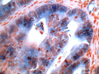 Immunohistochemistry (Formalin/PFA-fixed paraffin-embedded sections) - Anti-Cytokeratin 15 antibody [LHK15] (AB80522), expandable thumbnail