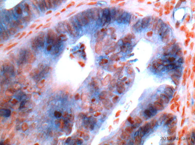 Immunohistochemistry (Formalin/PFA-fixed paraffin-embedded sections) - Anti-Cytokeratin 15 antibody [LHK15] (AB80522)