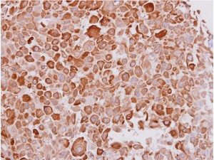 Immunohistochemistry (Formalin/PFA-fixed paraffin-embedded sections) - Anti-Cytokeratin 16/K16 antibody (AB154361), expandable thumbnail