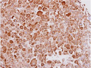 Immunohistochemistry (Formalin/PFA-fixed paraffin-embedded sections) - Anti-Cytokeratin 16/K16 antibody (AB154361)