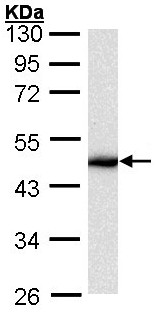 Western blot - Anti-Cytokeratin 16/K16 antibody (AB154361), expandable thumbnail