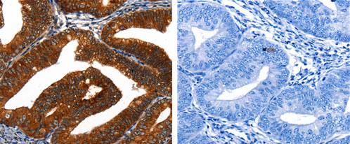Immunohistochemistry (Formalin/PFA-fixed paraffin-embedded sections) - Anti-Cytokeratin 16/K16 antibody (AB182791), expandable thumbnail