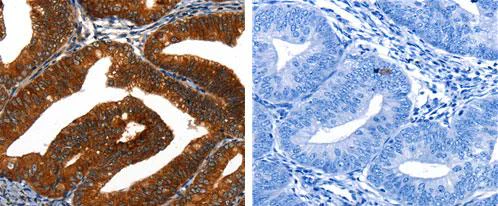 Immunohistochemistry (Formalin/PFA-fixed paraffin-embedded sections) - Anti-Cytokeratin 16/K16 antibody (AB182791)