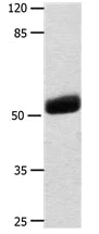 Western blot - Anti-Cytokeratin 16/K16 antibody (AB182791)