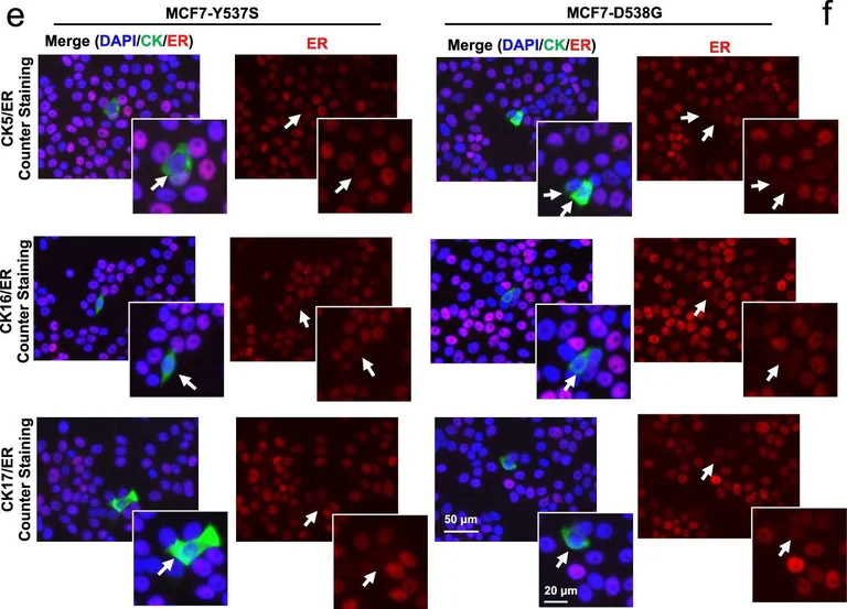 Immunocytochemistry/ Immunofluorescence - Anti-Cytokeratin 16/K16 antibody [EP1615Y] (AB76416)
