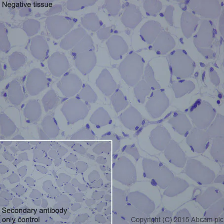 Immunohistochemistry (Formalin/PFA-fixed paraffin-embedded sections) - Anti-Cytokeratin 16/K16 antibody [EP1615Y] (AB76416)