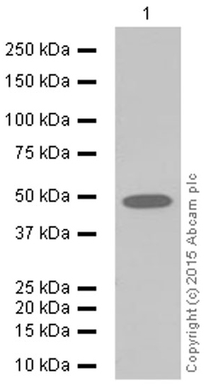 Western blot - Anti-Cytokeratin 16/K16 antibody [EP1615Y] (AB76416), expandable thumbnail