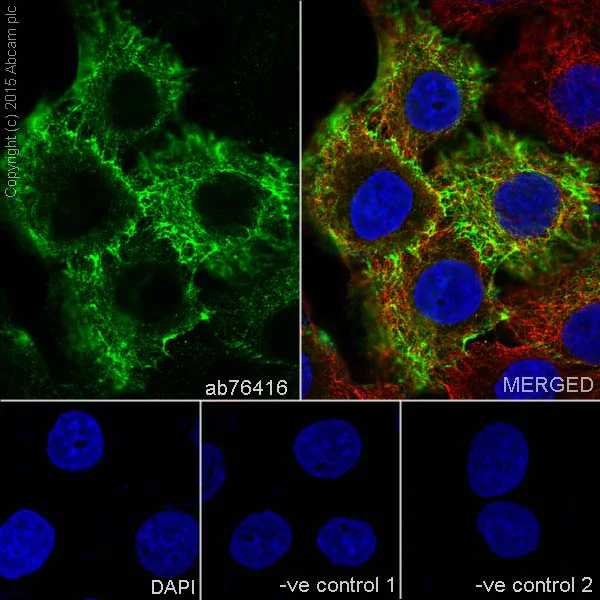 Immunocytochemistry/ Immunofluorescence - Anti-Cytokeratin 16/K16 antibody [EP1615Y] - BSA and Azide free (AB232522)