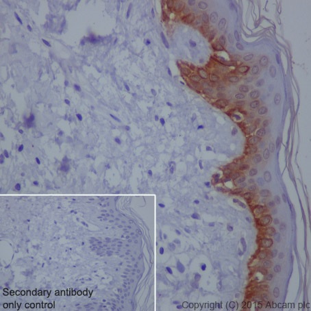 Immunohistochemistry (Formalin/PFA-fixed paraffin-embedded sections) - Anti-Cytokeratin 16/K16 antibody [EP1615Y] - BSA and Azide free (AB232522), expandable thumbnail