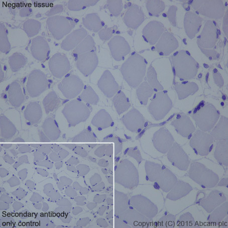 Immunohistochemistry (Formalin/PFA-fixed paraffin-embedded sections) - Anti-Cytokeratin 16/K16 antibody [EP1615Y] - BSA and Azide free (AB232522), expandable thumbnail