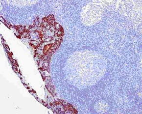 Immunohistochemistry (Formalin/PFA-fixed paraffin-embedded sections) - Anti-Cytokeratin 16/K16 antibody [EPR13504] (AB181055)