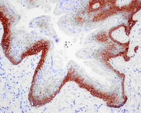 Immunohistochemistry (Formalin/PFA-fixed paraffin-embedded sections) - Anti-Cytokeratin 16/K16 antibody [EPR13504] (AB181055)