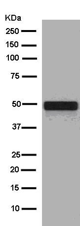 Western blot - Anti-Cytokeratin 16/K16 antibody [EPR13504] (AB181055)