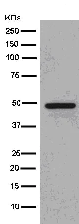 Western blot - Anti-Cytokeratin 16/K16 antibody [EPR13504] (AB181055)