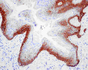 Immunohistochemistry (Formalin/PFA-fixed paraffin-embedded sections) - Anti-Cytokeratin 16/K16 antibody [EPR13504] - BSA and Azide free (AB240236), expandable thumbnail