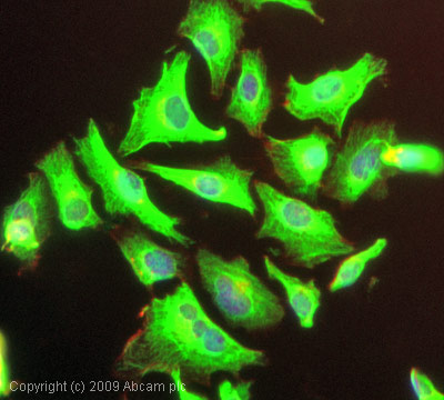 Immunocytochemistry/ Immunofluorescence - Anti-Cytokeratin 17 antibody - Cytoskeleton Marker (AB53707), expandable thumbnail