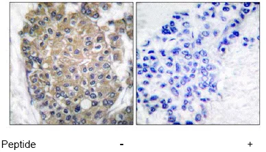 Immunohistochemistry (Formalin/PFA-fixed paraffin-embedded sections) - Anti-Cytokeratin 17 antibody - Cytoskeleton Marker (AB53707)