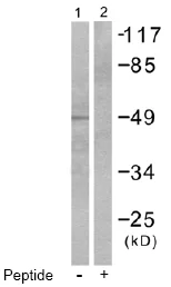 Western blot - Anti-Cytokeratin 17 antibody - Cytoskeleton Marker (AB53707)