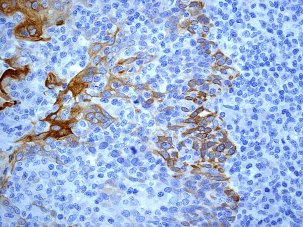 Immunohistochemistry (Formalin/PFA-fixed paraffin-embedded sections) - Anti-Cytokeratin 17 antibody [EP1623] - BSA and Azide free (AB239986)