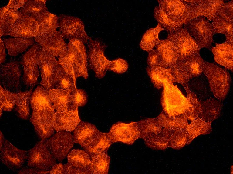 Immunocytochemistry/ Immunofluorescence - Anti-Cytokeratin 17 antibody [EP1623] - Cytoskeleton Marker (AB109725)
