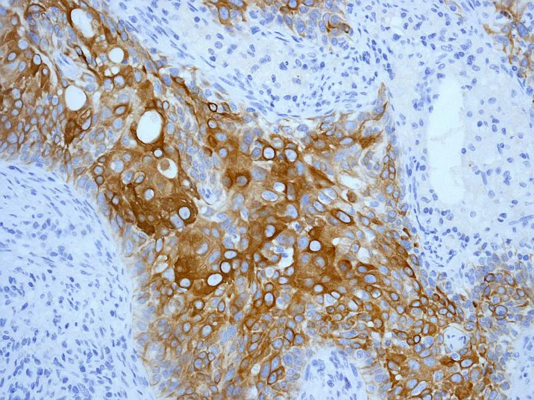 Immunohistochemistry (Formalin/PFA-fixed paraffin-embedded sections) - Anti-Cytokeratin 17 antibody [EP1623] - Cytoskeleton Marker (AB109725)