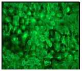Immunocytochemistry/ Immunofluorescence - Anti-Cytokeratin 17 antibody [EPR1624Y] (AB51056)