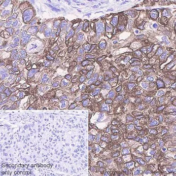 Immunohistochemistry (Formalin/PFA-fixed paraffin-embedded sections) - Anti-Cytokeratin 17 antibody [EPR1624Y] - BSA and Azide free (AB238953)