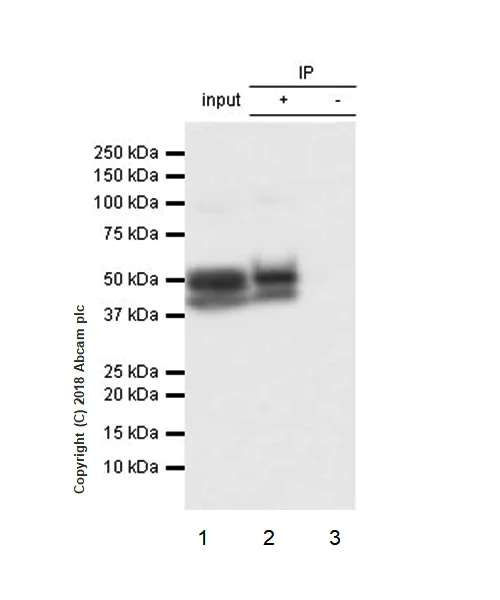 Immunoprecipitation - Anti-Cytokeratin 17 antibody [EPR1624Y] - BSA and Azide free (AB238953)