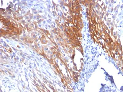 Immunohistochemistry (Formalin/PFA-fixed paraffin-embedded sections) - Anti-Cytokeratin 17 antibody [KRT17/778] - BSA and Azide free (AB212553)